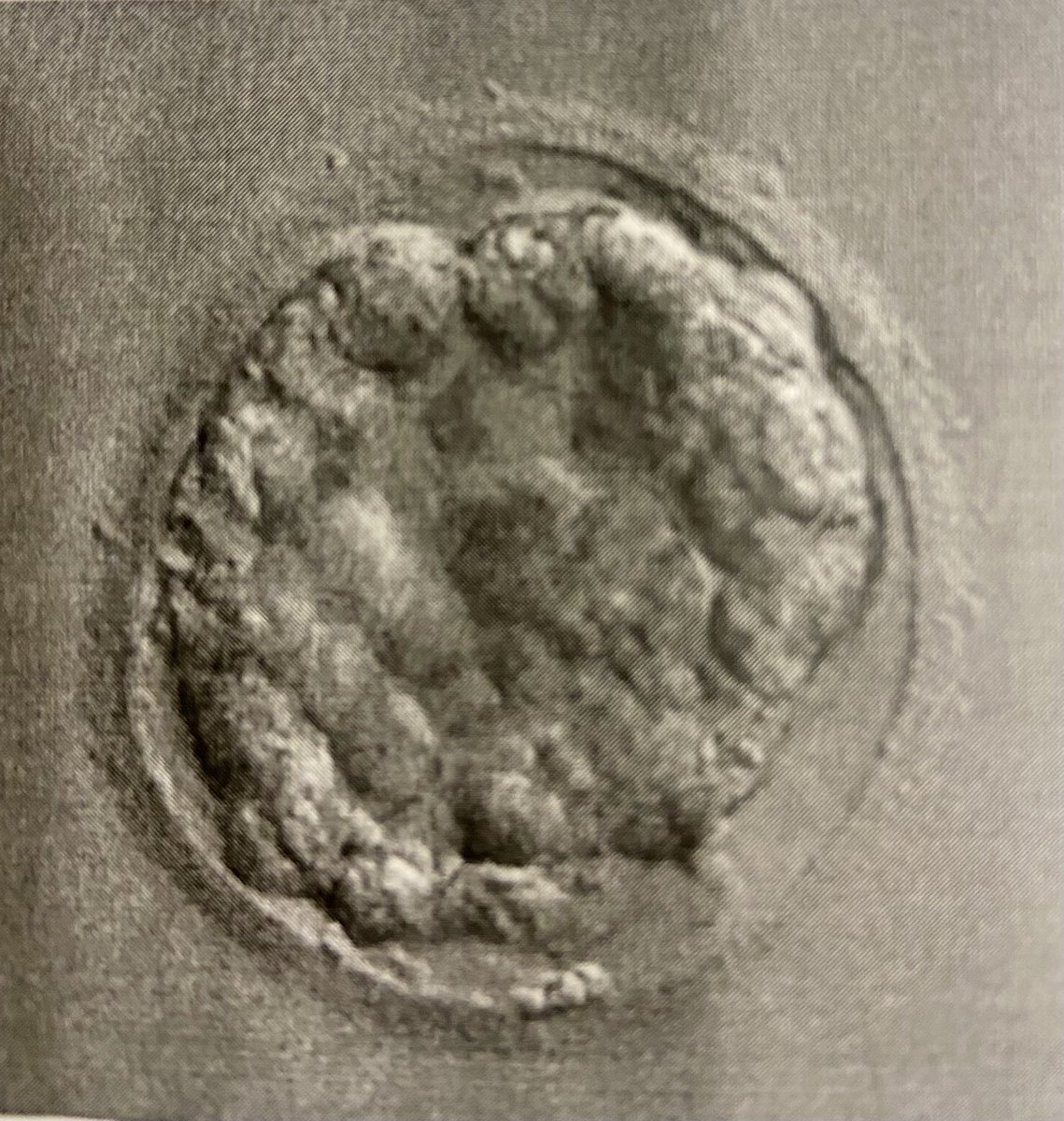 Te vamos a querer toda la vida ❤️ Agárrate bien fuerte pequechiño