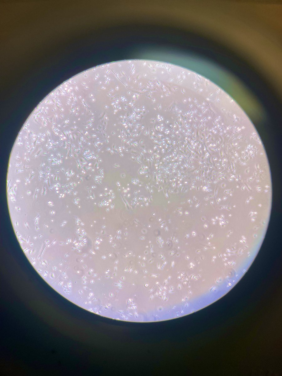 Carlos Hurtado Muñoz 🇨🇴 AAMC ID:15405408 (@ciencia_carlos) on Twitter photo A nice mesenchymal primary cell isolation (my first lol.) I’ve learned so many techniques and put them to use in my last couple months here at <a href="/The_Ito_Lab/">Keisuke_Ito_Lab (Old)</a>
The support from <a href="/Cla_Morganti/">Claudia Morganti</a> has been crucial throughout my journey here! :) A nice mesenchymal primary cell isolation (my first lol.) I’ve learned so many techniques and put them to use in my last couple months here at <a href="/The_Ito_Lab/">Keisuke_Ito_Lab (Old)</a>
The support from <a href="/Cla_Morganti/">Claudia Morganti</a> has been crucial throughout my journey here! :)