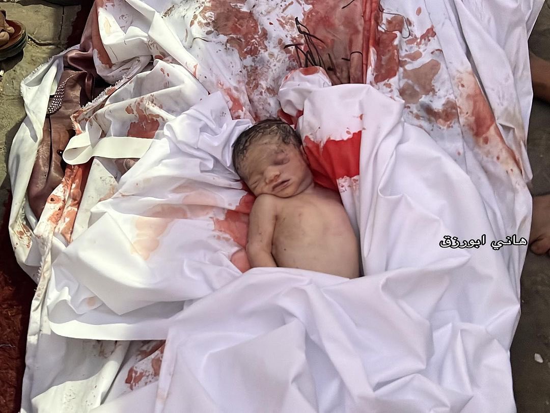 الجنين الي قدامكوا استشهدت والدته وهو في بطنها حاول الاطباء انقاذه لكنه فارق الحياة

اخد شهادة الوفاة قبل شهادة الميلاد