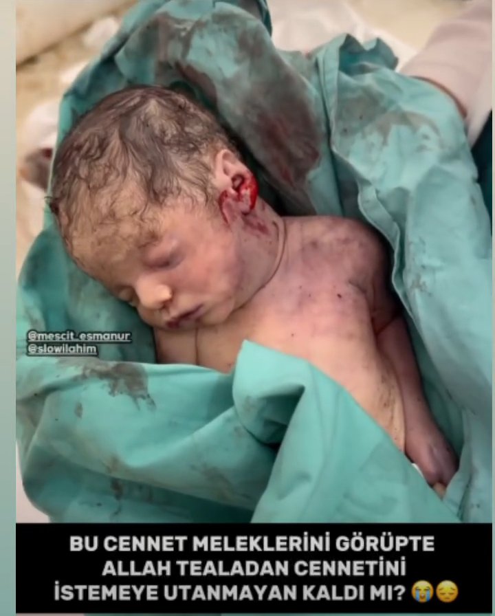 Barbarlar barbar ordusu sizin adaletiniz insan haklarıniz  yerin dibine batsın.
Yağmacılar  . Bu dünya Yahudi terörden kurtulması lazım .