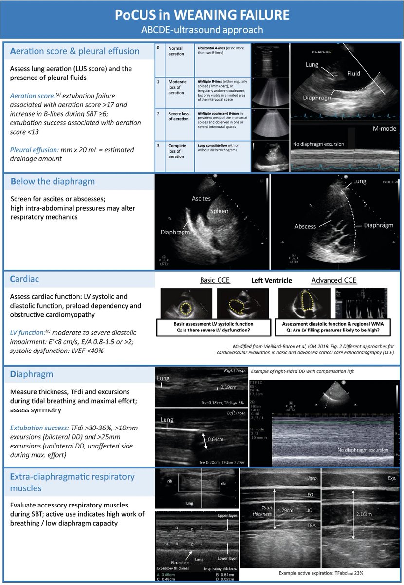 #POCUS in patients with weaning failure: the ABCDE approach. 🔗link.springer.com/article/10.100… #MedEd #FOAMed #FOAMcc #CriticalCare