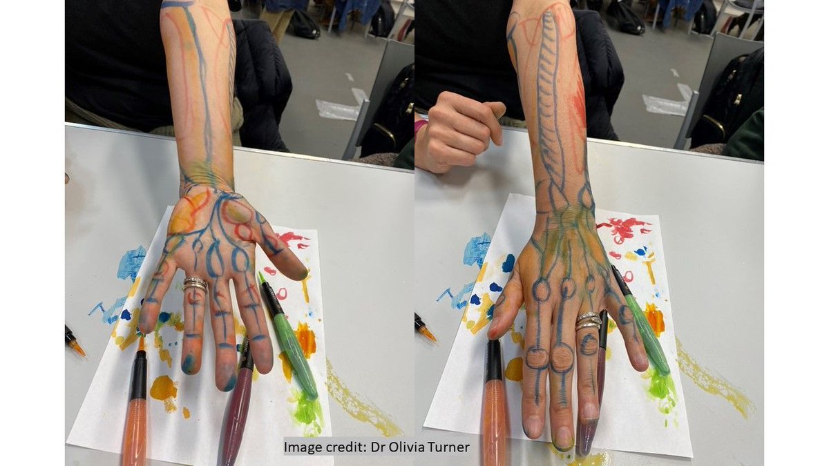 A departmental seminar grant was awarded to Dr Iain Keenan (Newcastle University) to host Mr Leonard Shapiro (University of Cape Town) for art based anatomy education workshops. The image below shows what they got up to! Read the report here --&gt; buff.ly/477GFCQ