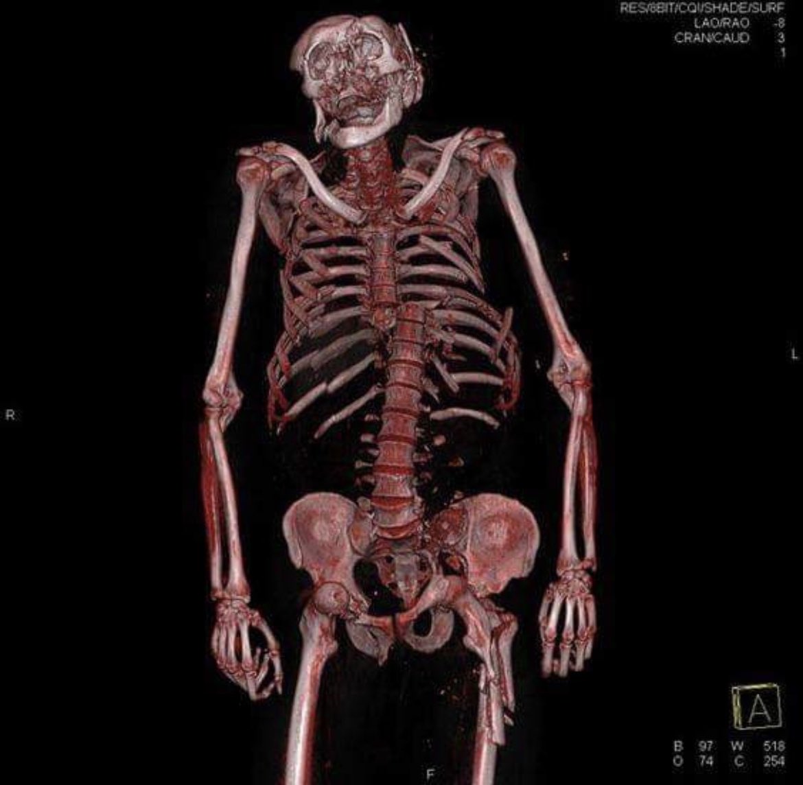 Morbid Knowledge tweet media