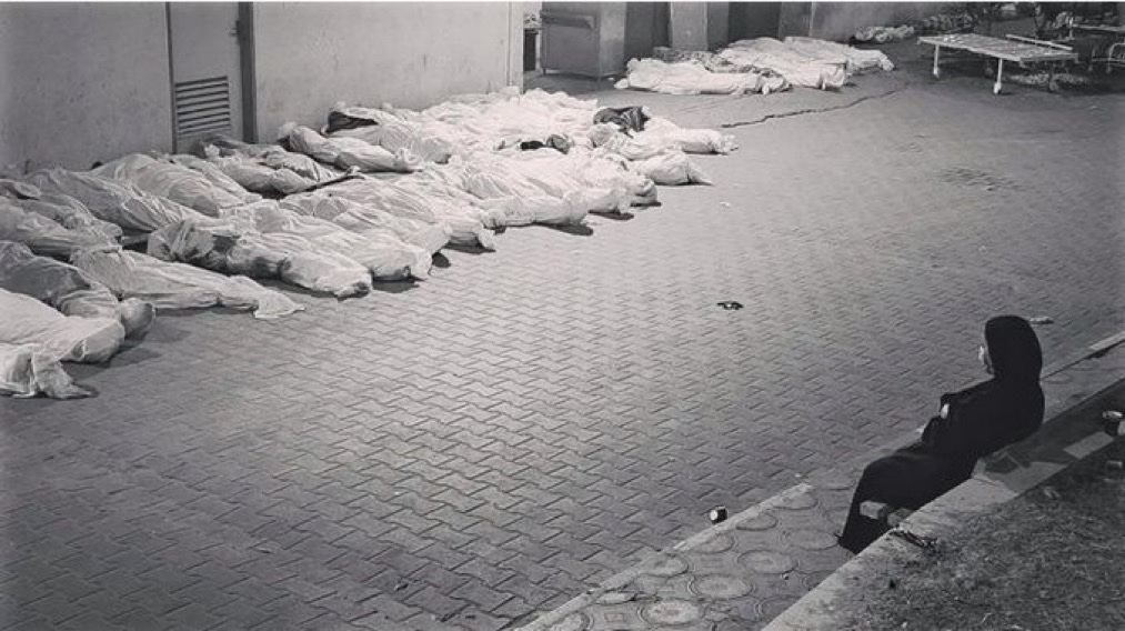 ما في كلمات بتعبر عن مدى الألم في الصورة 💔 !