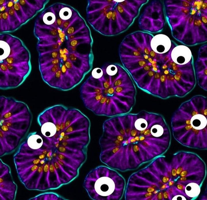NeuroQuinn's tweet photo. Immunofluorescence staining of small intestine highlighting the cell membrane ( purple) brush border ( teal) and nuclei ( yellow) in floating villi .
Googly eyes - just for fun .
#MicroCreepy #HappyHalloween
#HappyHalloween2023
📷Amy.E https://t.co/Zy8lg0IAtU