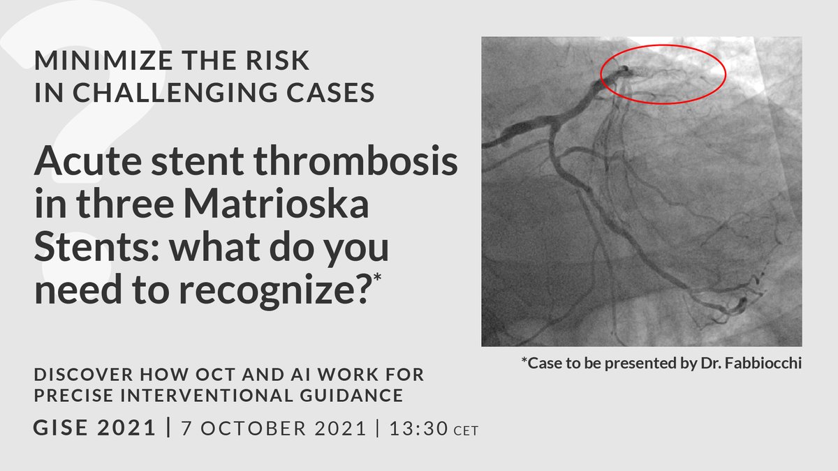 Sici GISE (@sicigise) on Twitter photo Poll for Interventional Cardiologist
What is essential to recognise in the treatment of acute stent thrombosis?
KEEP DISCUSSING IT AT GISE ABBOTT SYMPOSIUM
with <a href="/FFabbiocchi/">Franco Fabbiocchi</a> , Carlo Di Mario, Carlo Cernetti and Giulio Gualgiumi Poll for Interventional Cardiologist
What is essential to recognise in the treatment of acute stent thrombosis?
KEEP DISCUSSING IT AT GISE ABBOTT SYMPOSIUM
with <a href="/FFabbiocchi/">Franco Fabbiocchi</a> , Carlo Di Mario, Carlo Cernetti and Giulio Gualgiumi