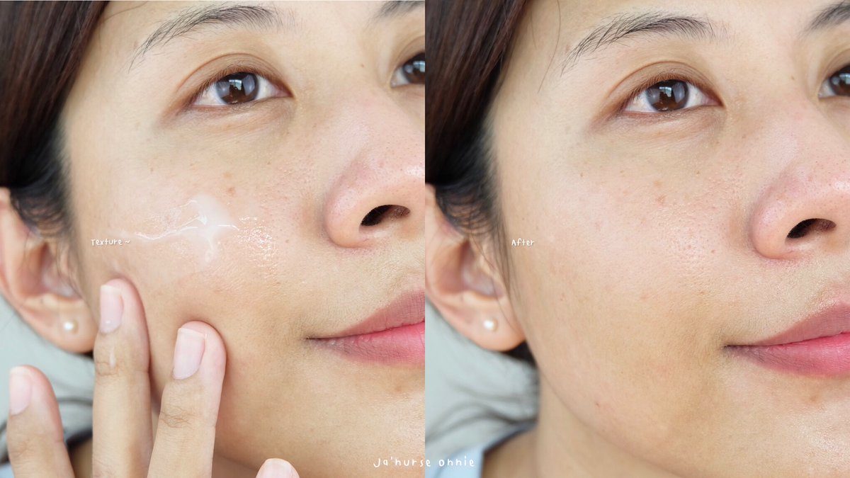 nursejk_'s tweet image. แวะมาป้ายยากับ Skin Barrier+ Prebiotic Serum in Cream แบรนด์ @fyneofficial ตัวนี้เน้นช่วยในเรื่องเติมความชุ่มชื้น ปลอมประโลมผิว พร้อมทั้งเสริมความแข็งแรงของเกราะป้องกันผิวด้วยนะ ปราศจากแอลกอฮอล์ พาราเบน ผิวแพ้ง่ายใช้ได้แน่นอน เนื้อเกลี่ยง่ายมาก ไม่เหนียวผิวเลย #ใช้ดีบอกต่อ