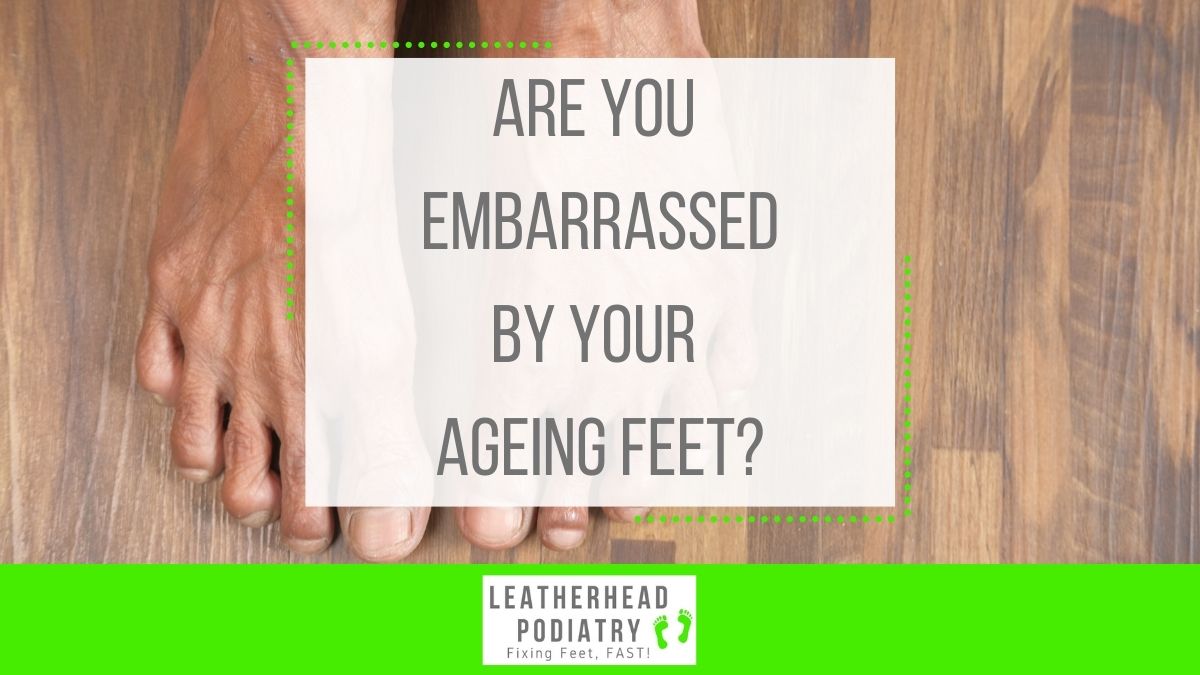 With general signs including regular aches &amp; pains, bunions and clawing of the toes, ageing feet can be an embarrassment. To see how we can help, call us on 01372 374125 or visit leatherheadpodiatry.co.uk.

#LeatherheadPodiatry #FootCareClinic #Podiatrist #Leatherhead #Surrey