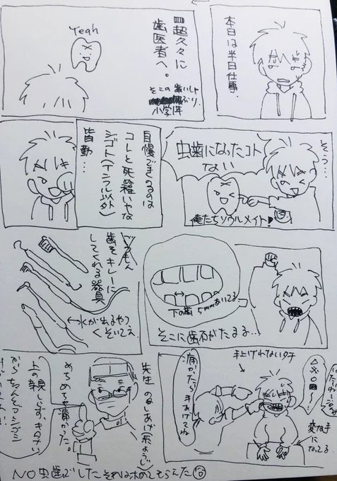 親知らず磨くのは顎の限界を超えろと言うこと… 
