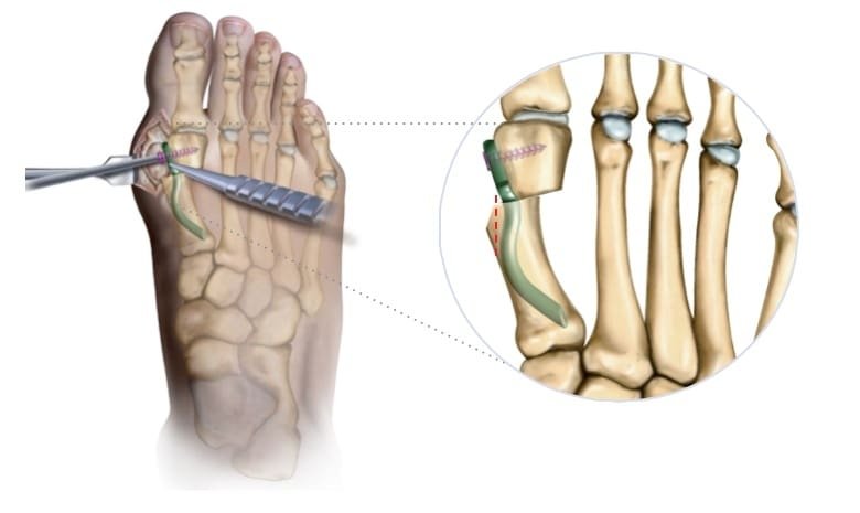 SD Trauma tweet media