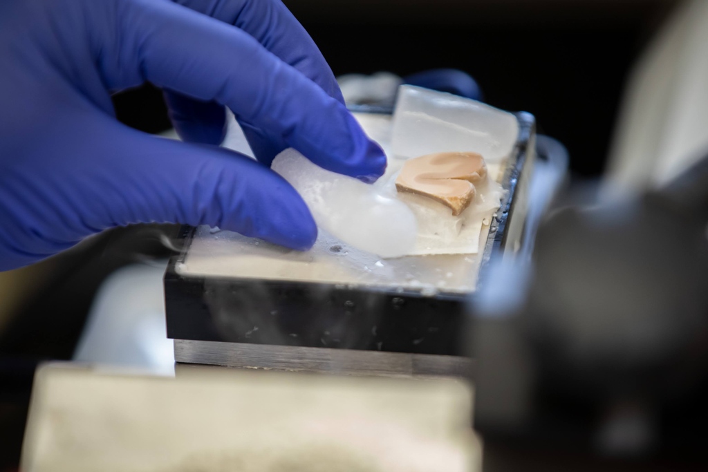marblespod's tweet photo. The Big Brain is a super important project that used a gigantic deli slicer to cut razor thin pieces of an individual brain, and map it to create a baseline for further research. Dr. Alan Evans tells us all about it in episode 3! Go listen: 

https://t.co/gPux8i1EXP https://t.co/FS2nun7eFG