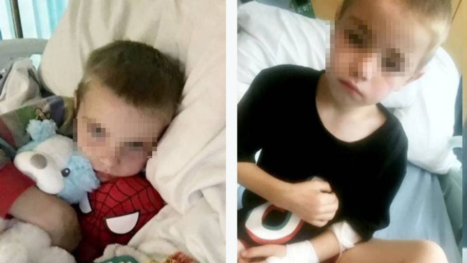 PRESIDIOYucatn1's tweet photo. #Notixec
Mamá se horroriza al descubrir qué le perforó el pulmón a su hijo de siete años
Información aquí 👇
https://t.co/FS2l40bwZK https://t.co/OTGvP1suNn