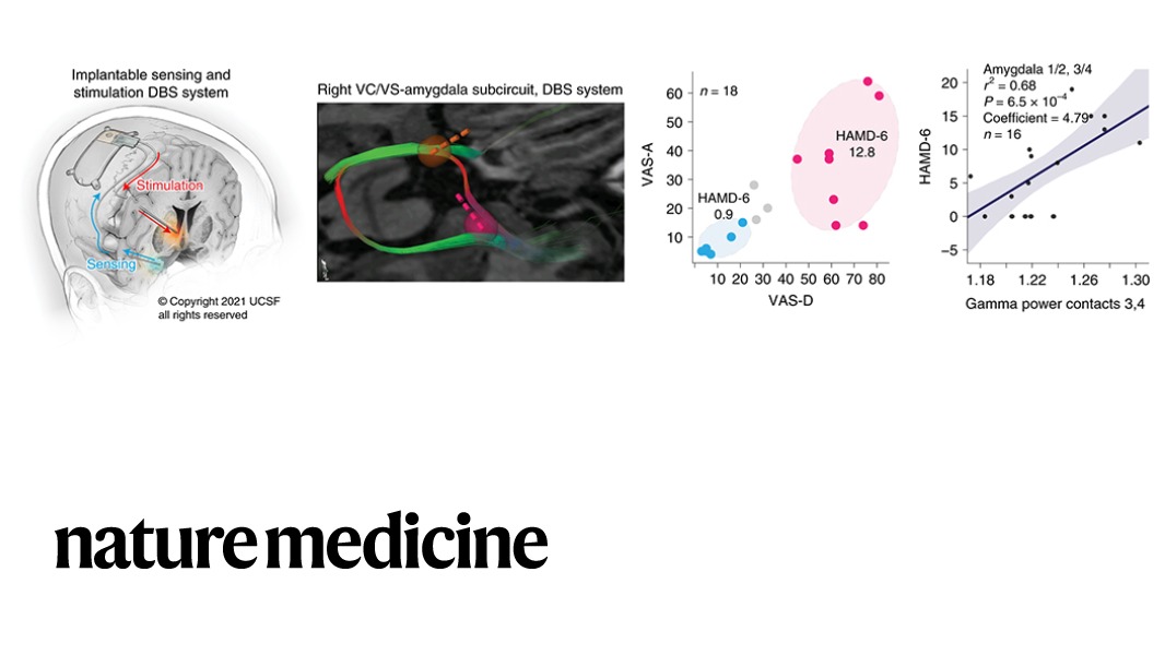 NaturePortfolio's tweet photo. A @NatureMedicine paper presents the treatment of severe depression in a single individual using a surgically implanted device that automatically triggers brain electrical stimulation in states of high depression severity. https://t.co/JJJoyYwBKd https://t.co/omXRk1sV3E