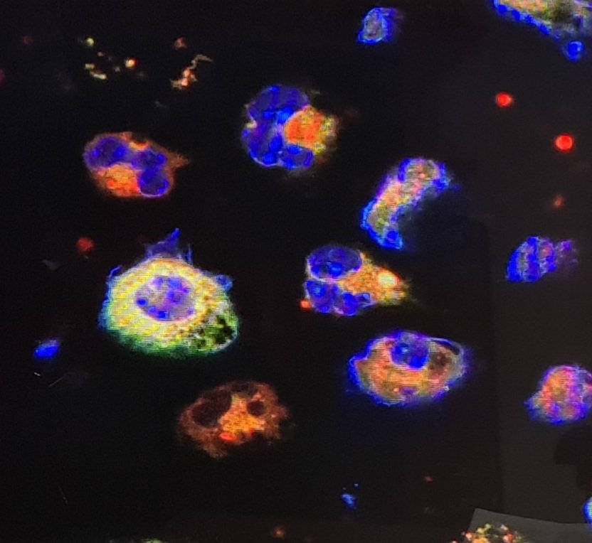 Dr Lucy Jackson-Jones (@lucyhjackson_j) on Twitter photo Very happy to Welcome <a href="/NimuMacharia/">Sheila Macharia</a> who has joined the <a href="/JacksonJonesLab/">Jackson-Jones Lab</a> <a href="/BLSLancasterUni/">BLS Lancaster University</a> I'm really excited for our next few years of pleural cavity research! Very happy to Welcome <a href="/NimuMacharia/">Sheila Macharia</a> who has joined the <a href="/JacksonJonesLab/">Jackson-Jones Lab</a> <a href="/BLSLancasterUni/">BLS Lancaster University</a> I'm really excited for our next few years of pleural cavity research!