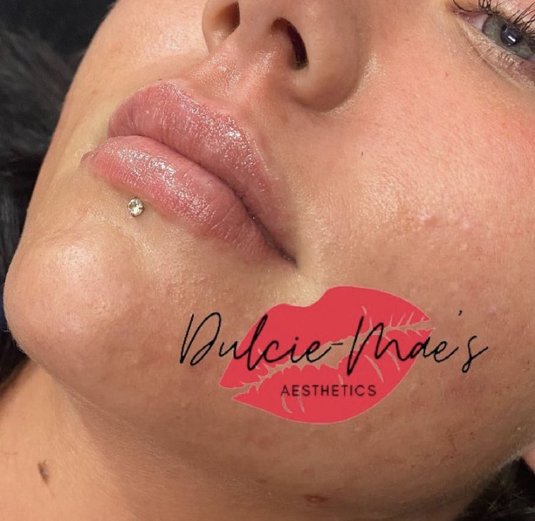 MegSalmonF's tweet photo. Anyway here’s an update for all my Twitter followers 🥰 I know do beauty and aesthetic treatments 🤍 https://t.co/MXQnwl8uud