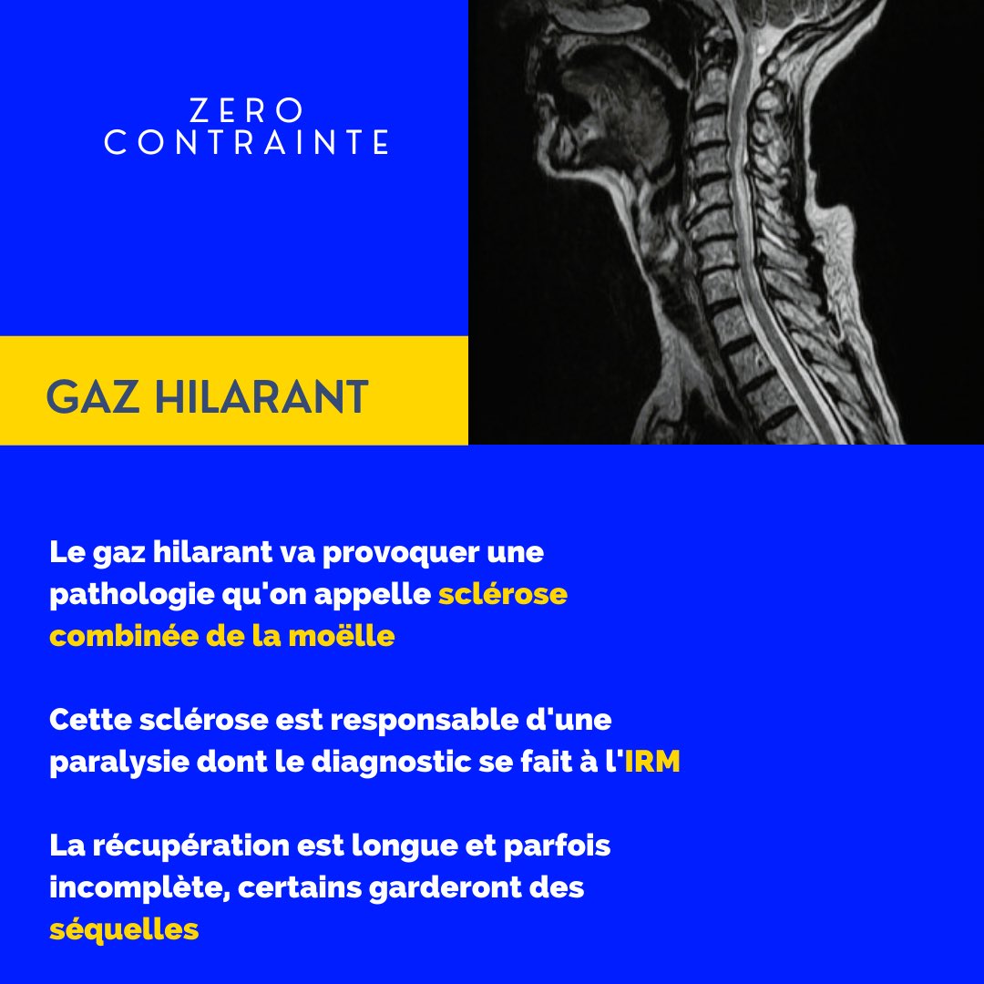 Dr_moji's tweet photo. En attendant une vraie politique de lutte contre ce fléau, voici quelques infos sur les risques du fameux « gaz hilarant ». 
Prévenez les plus jeunes qu’ils finiront paralysés. Certains garderont des séquelles. https://t.co/xTSd0jnxid