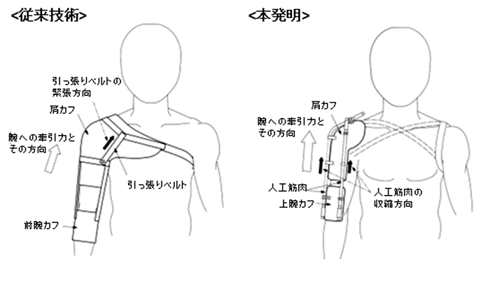 KIO_University's tweet photo. 健康科学研究科の庄本康治教授と冬木正紀准教授の発明が特許を取得！
https://t.co/RU27oXqngN
脳卒中片麻痺により亜脱臼した肩関節を整復させる力が飛躍的に向上したリハビリ用肩装具を発明しました。収縮力の強い人工筋肉を導入しています。
#畿央大学 #理学療法学科 #健康科学研究科 https://t.co/vOYh0WCXhO