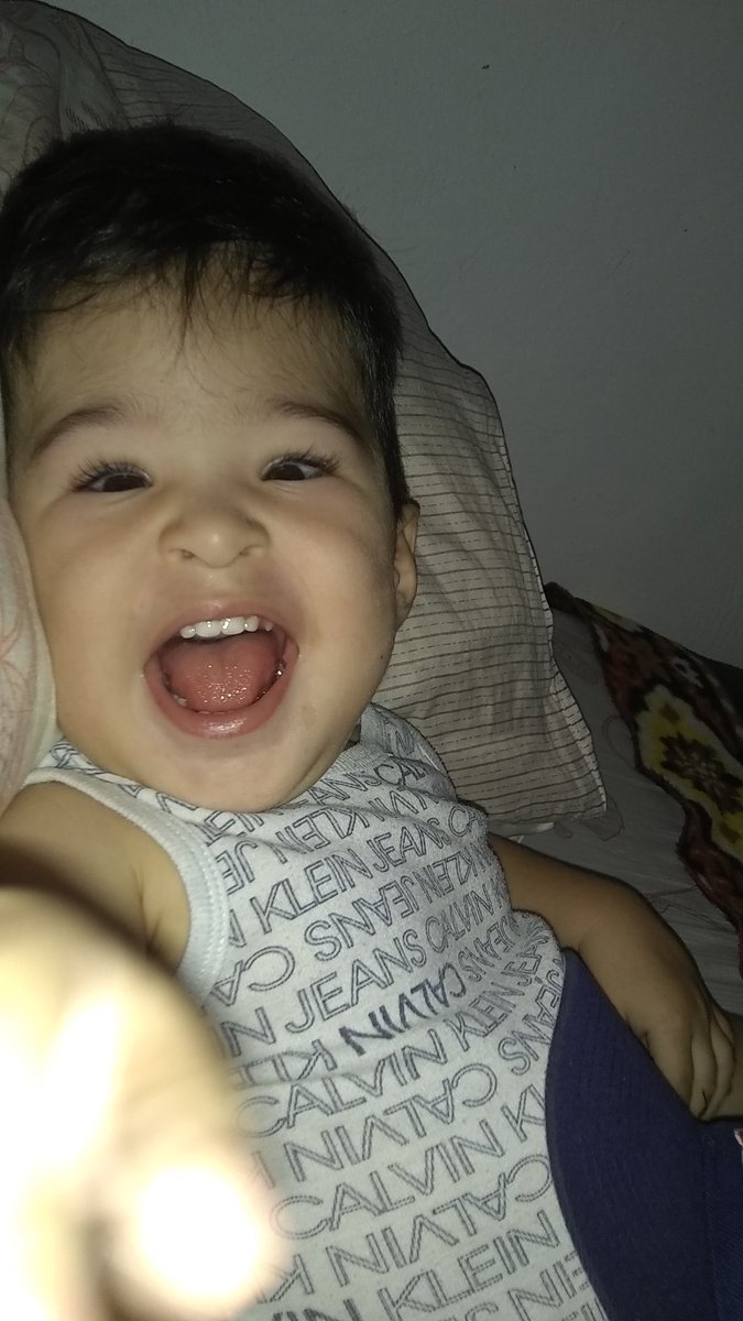 AlexaGomezDos's tweet photo. Ramsés es un bebé de 1a 4m, que nació con una condición llamada myelomeningocele,el cual causa hidrocefalia congénita.Tiene válvula de presión media y no tiene movilidad de sus miembros inferiores.Estamos buscando un coche en donación para que asista a sus terapias. GRACIAS #CCS https://t.co/oxR3zhLKVg