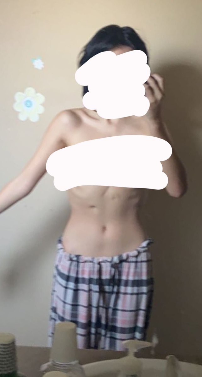 buniispo's tweet photo. sept bodychecks
tw ana
#notproana #bodycheck #EDtwt #proanatwt
also meanspo me plsss i gained::
-
-
-
- https://t.co/rp188CmQlR