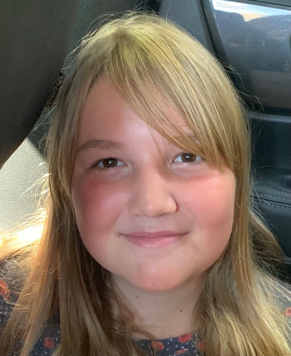 Meet sepsis survivor, Sophia Moore. Sophia, 13, has experienced sepsis 3 times so far in 2021. The first was the most disastrous because it caused an 8-minute cardiac arrest from septic shock that damaged all of her major organs &amp; eventually caused a bowel perforation. #saysepsis