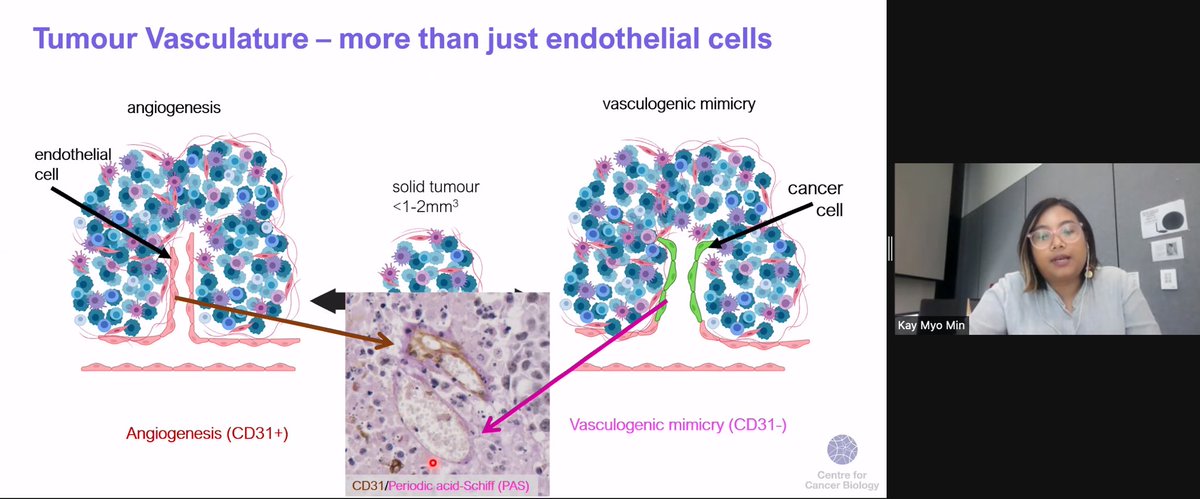 ANZMS2's tweet photo. Next we have an invited talk from @kay_mmin @UniversitySA. Vasculogenic mimicry (VM) is a predictor of poorer survival outcomes in cancer patients. Kay works on the different contributors of VM, in hopes to identify novel targets to increase survival of cancer patients #ANZMS2021 https://t.co/rpEetsdDnh