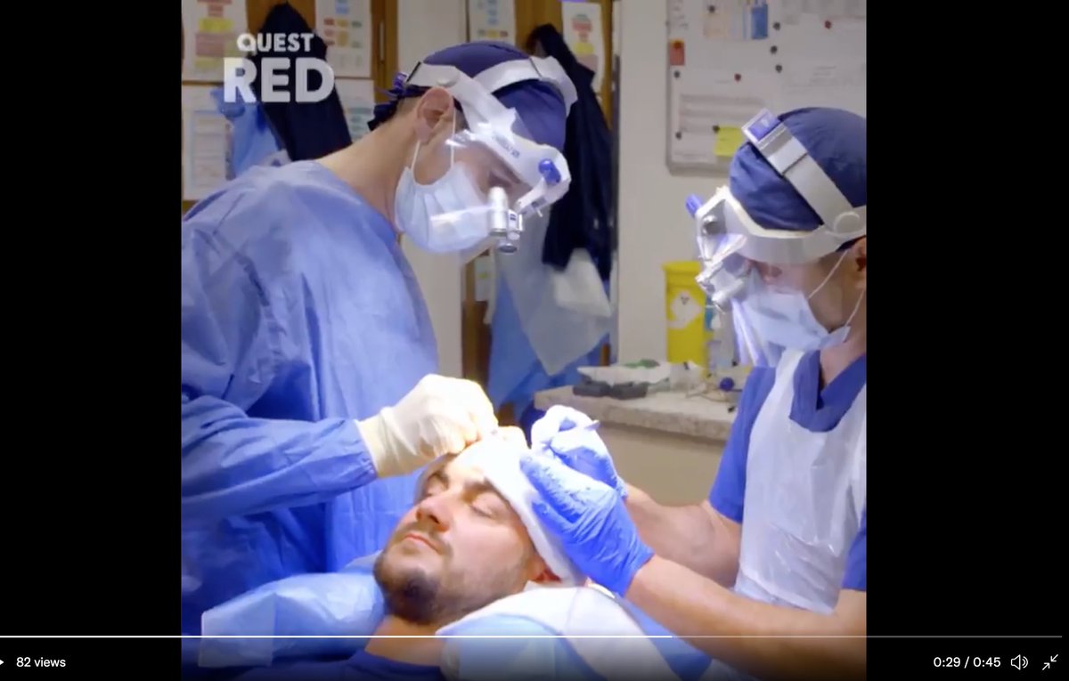 Just one week to go to watch #thehairlossclinic on Quest Red. The series follows patients with varying hairloss conditions and hair transplant surgery with Dr Edward Ball. We can’t wait to watch it. #hairtransplant