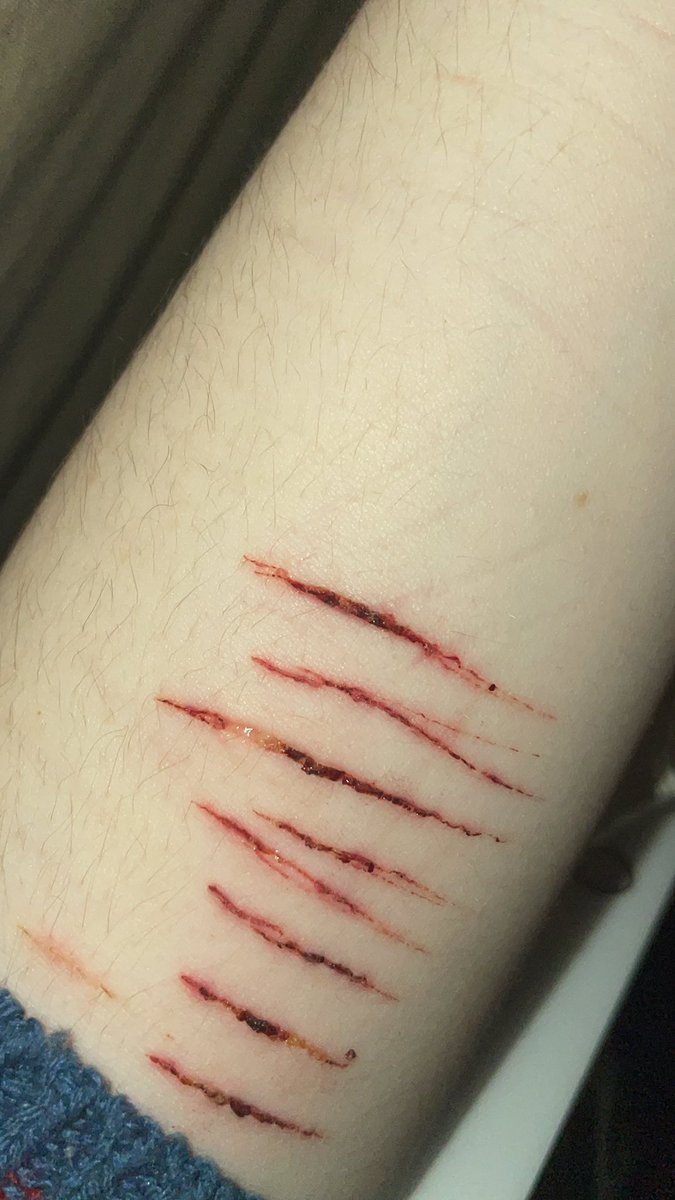 ja3z_'s tweet photo. is it infected? if so, what should i do? https://t.co/T7lYx5xPIB
