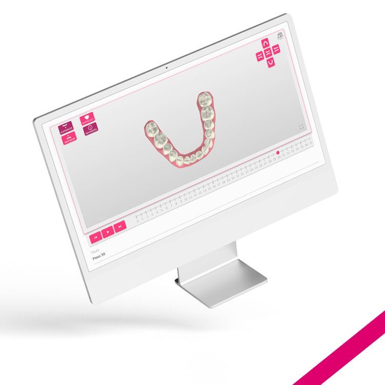 Geniova's tweet photo. Así es el set-up 3D gratuito 😎 de #Geniova! 
Con este setup interactivo, es más fácil mostrarle al paciente los cambios que va a notar, en cuánto tiempo va a verlos y cuántos #alineadoresinvisibles va a necesitar! 😁 Quieres saber más?
💻https://t.co/XFrIbtGyfi
#ortodoncia https://t.co/oHVNuvaGjp