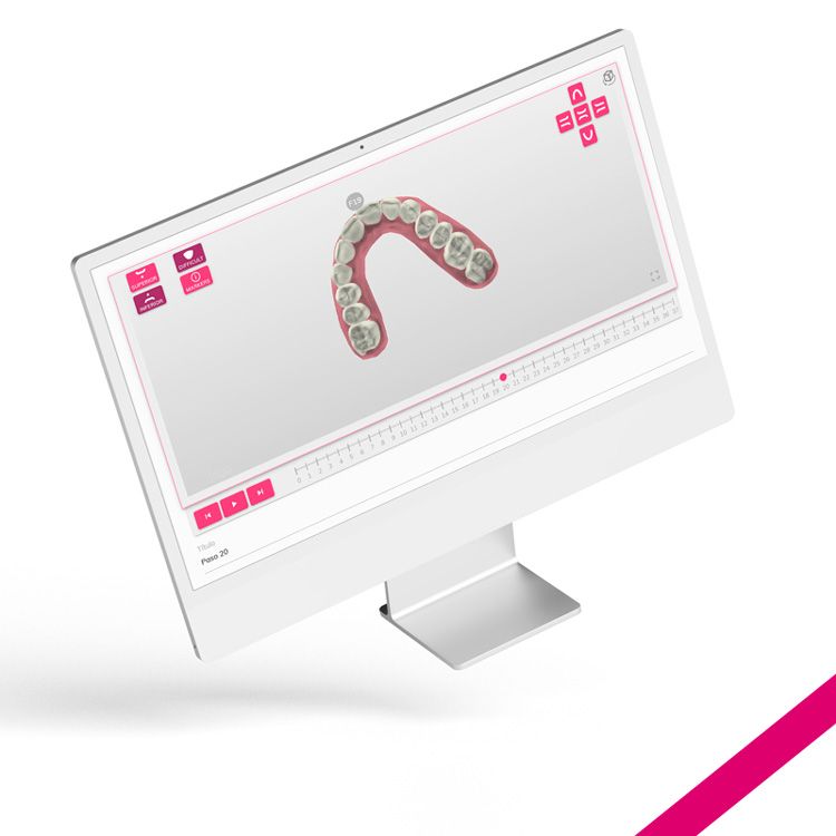 Geniova's tweet photo. Así es el set-up 3D gratuito 😎 de #Geniova! 
Con este setup interactivo, es más fácil mostrarle al paciente los cambios que va a notar, en cuánto tiempo va a verlos y cuántos #alineadoresinvisibles va a necesitar! 😁 Quieres saber más?
💻https://t.co/XFrIbtGyfi
#ortodoncia https://t.co/oHVNuvaGjp