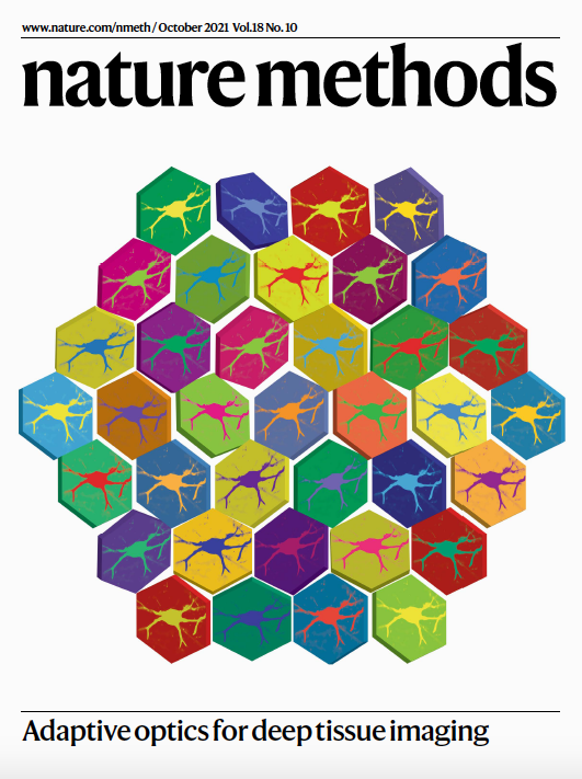 naturemethods's tweet photo. Our October issue is now live! We just love this pop art illustration of an adaptive optics module for deep tissue imaging, from @crisrodtsou and @M_A_Mohr 
(paper here: https://t.co/dqZqjtjqf0). 🎉 https://t.co/lpKZCZ3fLX