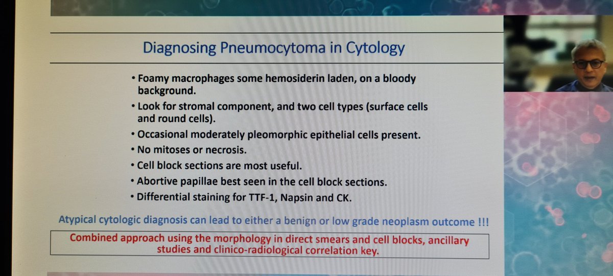 mdlozanoe's tweet photo. How many times did you make a cytological diagnosis of Pneumocytoma???👀👀🥺🥺. @mtsiddi gives us valuable guidelines for dealing with this entity 🙌👏👏#ECC2021Wroclaw https://t.co/oCzUaU8TXw