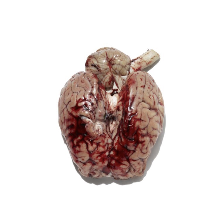 For the October issue of <a href="/MensHealthUK/">Men's Health UK</a>, I wrote about the psychiatric effects of #steroids: euphoria, irritability, aggression, hyperactivity, impaired judgement, violence, depression, suicidal ideation, paranoia and delusions of grandeur 💉💪🧠 #arushofbloodtothehead