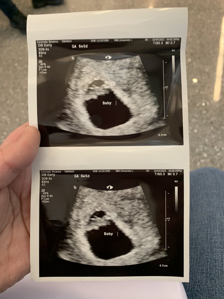 RoxannaCoronad1's tweet image. Can’t wait for our rainbow baby coming May 2022 🌈🥰👶🏻 words Can not express how much love I have for you already ❤️🥰