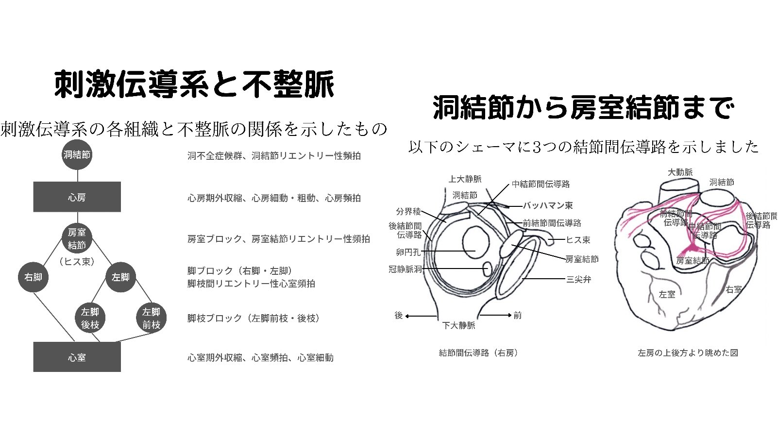 心電図くま on X: 