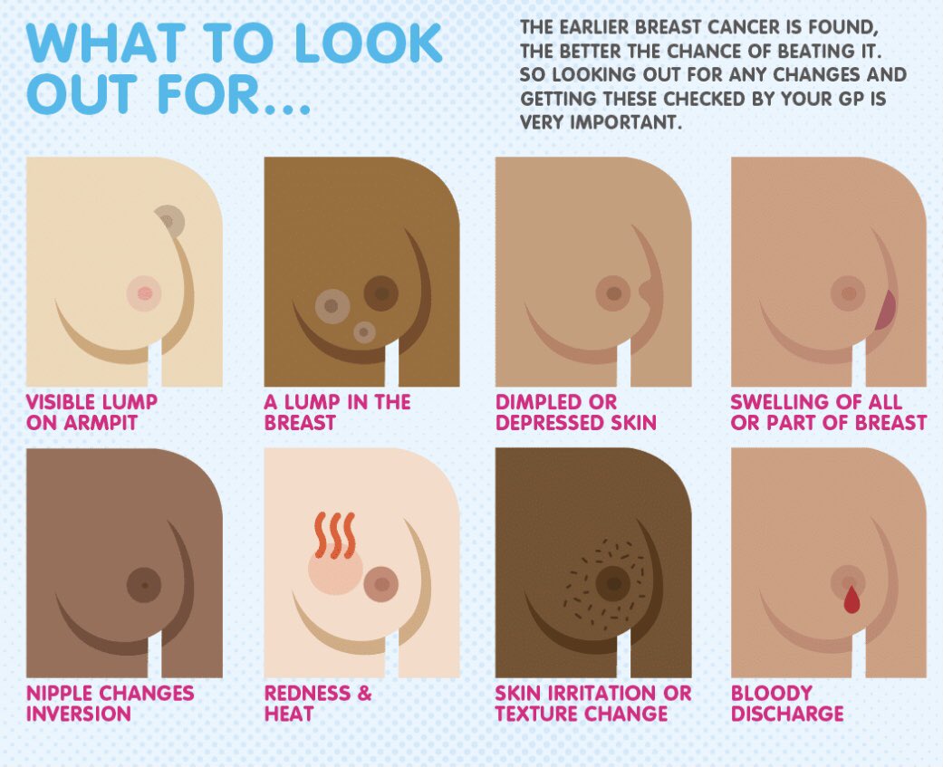 October is Breast Awareness month, so <a href="/LancsHospRT/">LancsHospitalsRadiotherapy</a> ACPs have teamed up with Breast Care Nurses <a href="/Lucy_Worthy/">Lucy Worthington</a> and <a href="/karen_anton/">Karen Anton</a>, <a href="/info_macmillan/">PrestonMacmillanInfo</a> and the Cancer Care Coordinators to educate patients and staff on the importance of checking breasts regularly and attending screening!