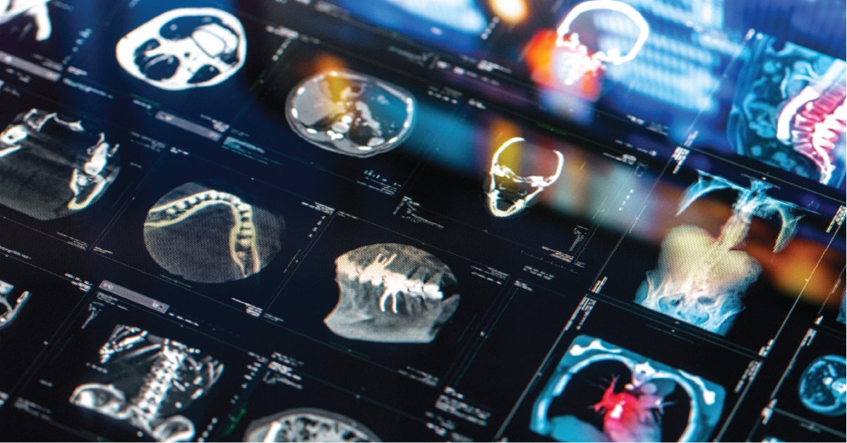 Stop using temporary solutions to solve your PACS problems! Our PACS Considerations Checklist will help you find a long term PACS Replacement solution. 

bit.ly/3mqaEjJ