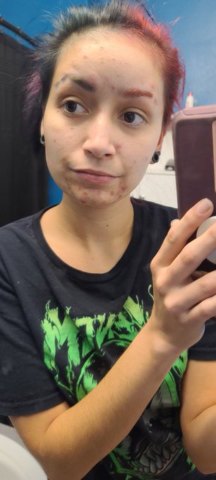 When they only care about your body and not mental health. This acne is going to be the death of me.<a href="/tag/bigdick"class="tags"><span>#bigdick</span></a><a href="/tag/onlyfans"class="tags"><span>#onlyfans</span></a><a href="/tag/pornhubmodel"class="tags"><span>#pornhubmodel</span></a><a href="/tag/onlyfansmuscle"class="tags"><span>#onlyfansmuscle</span></a>