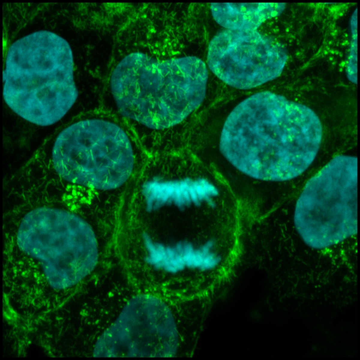 DLMQN's tweet image. Yes I am very easily distracted on the microscope with unrelated but really cool things #anaphase