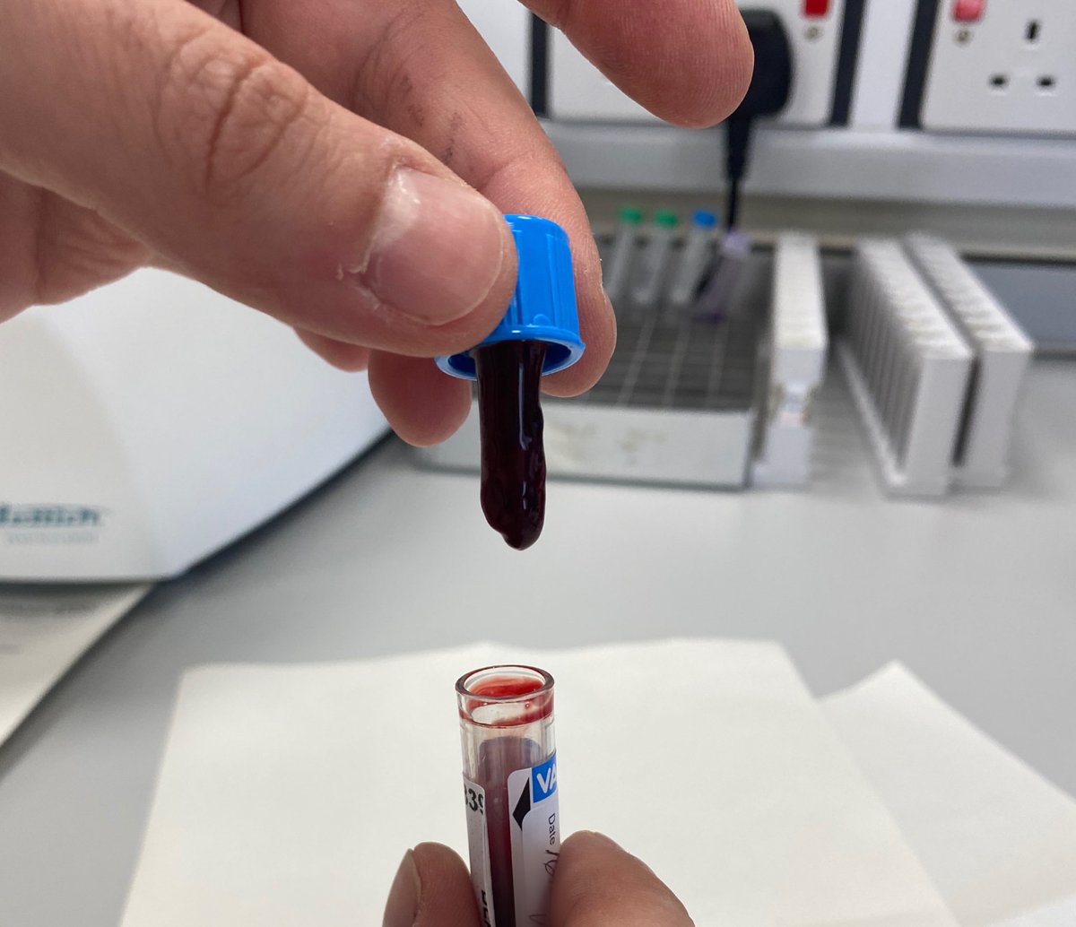 AVBarnard98's tweet photo. Blood taker: ‘I took the sample myself, it can’t be clotted’ 
Sample: https://t.co/y9AIWPm8xL