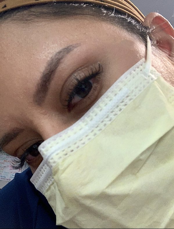 kwelch2013's tweet photo. Day of vs two weeks out! Still have some healing to do but can’t wait for my touch up appt in several weeks! https://t.co/mbMeYl9zK0