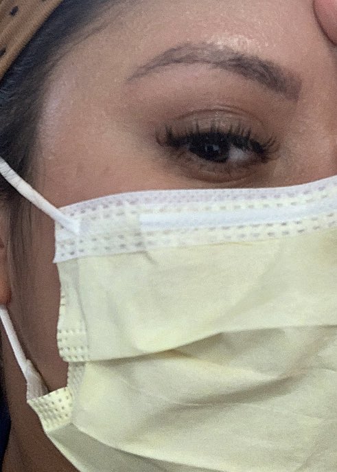 kwelch2013's tweet photo. Day of vs two weeks out! Still have some healing to do but can’t wait for my touch up appt in several weeks! https://t.co/mbMeYl9zK0
