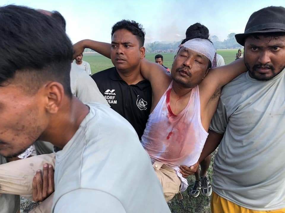 Tishunsrang1's tweet photo. @khanumarfa This is what the actual picture of Assam. Today we can really feel how much Depth they have penetrated their roots in our land without legal permission. We have not even guts to ask them about their Identity, even our forces are seriously injured.#WeSupportAssamPolice https://t.co/IRsYh0l8Mw