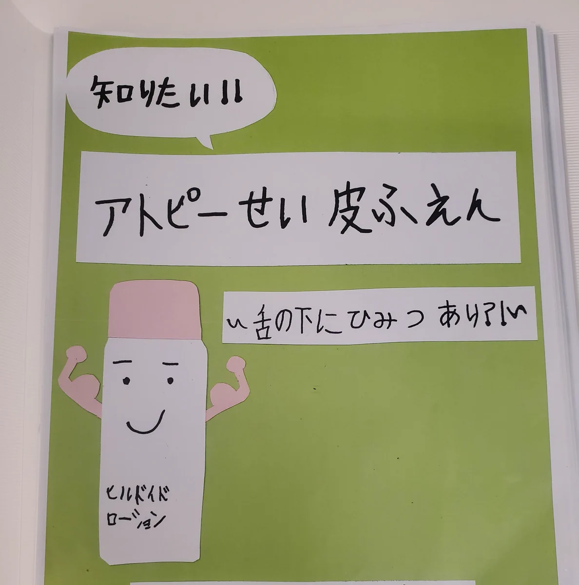 アトピー性皮膚炎についての自由研究！小学生とは思えない充実した内容！