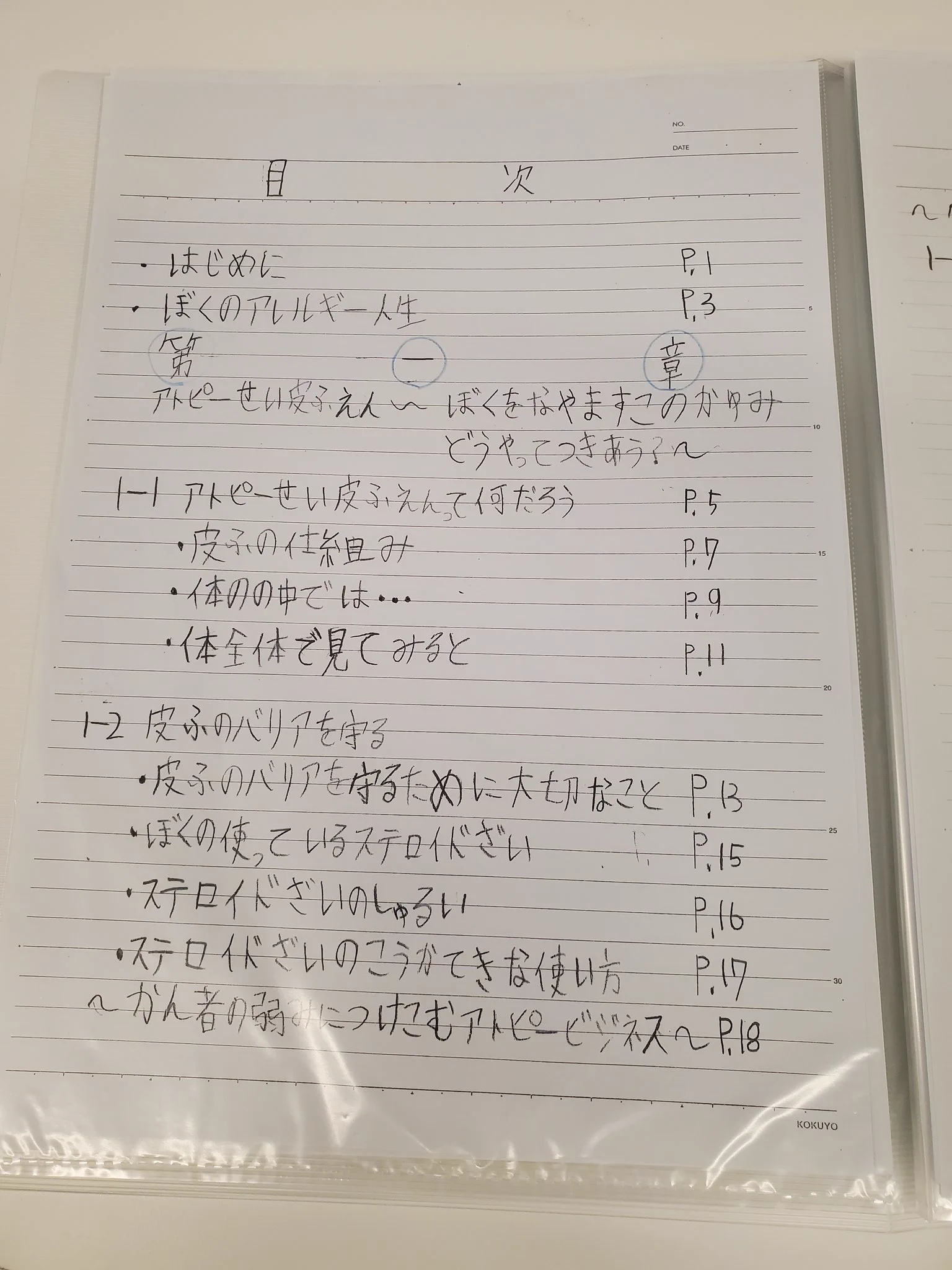 アトピー性皮膚炎についての自由研究！小学生とは思えない充実した内容！