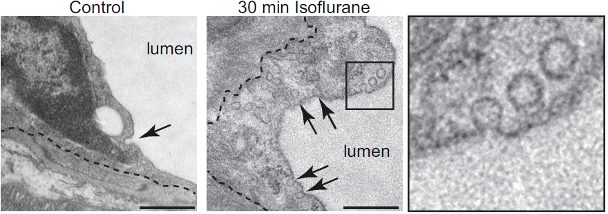 GesineSaher's tweet photo. Increased density of caveolar profiles in isoflurane treated mice https://t.co/QzGdQQ0Zp1