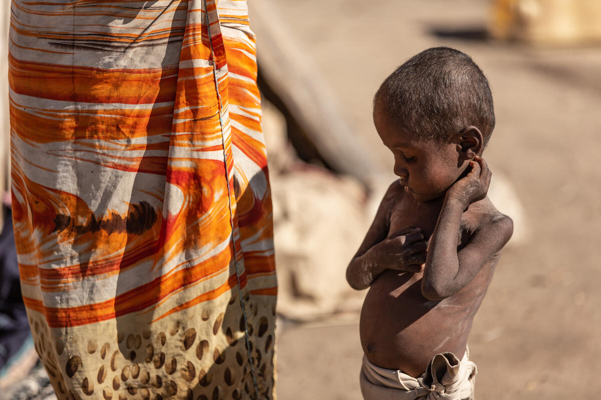 WFPChief's tweet photo. MILLIONS of people are starving today. If we wait to act, many might not see the end of 2021. The world cannot turn a blind eye any longer!

Because in the time it took you to read this tweet, a child has died of hunger. #Ethiopia #Madagascar #SouthSudan #Yemen and many more. https://t.co/hJw5Nt60ON
