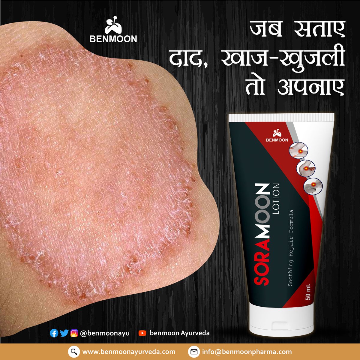 benmoonayurveda.com
#benmoonproductchallenge
#itching #skinirritation #daadkhujli #SkinItching #RINGWORM #daadkhajkhujli