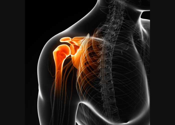 rileywilliamsMD's tweet photo. Like the rest of us, #olympic swimmers can experience shoulder pain - often due to overuse of the #rotatorcuff. Learn how to recognize and treat #rotatorcuffpain at https://t.co/eSBerb3S3S. #sportsmedicine #orthotwitter https://t.co/lRnvDaBzwj