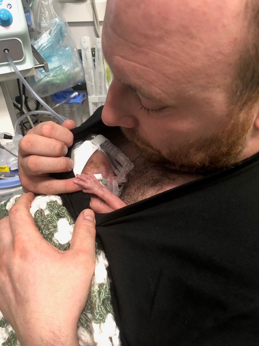 RotundaCharity's tweet photo. Thank you to Oisín’s parents for sending in his story and some pictures. We love to hear how Rotunda babies are getting on. Oisín had a tough start but is doing so well now!
#RotundaBaby #NICU #NICUStrong https://t.co/wdI3dgSIkp