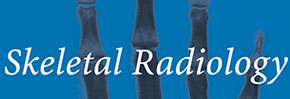 Dr_Hugue_Ouellette (@drhugue) on Twitter photo Squats!
New Paper: Repetitive trauma-induced extra-nuchal-type fibroma
pubmed.ncbi.nlm.nih.gov/34554278/
<a href="/SkeletalRadiol/">Skeletal Radiology</a> <a href="/DrMallinson/">Dr Paul Mallinson</a> <a href="/JanFritzMSK/">Jan Fritz</a> <a href="/Vilavaite/">María J. Díaz Candamio</a> <a href="/carlespedret/">carlespedret</a> <a href="/dflemosmd/">Diego Lemos</a> <a href="/yan_yet/">YY Yan</a> <a href="/MskSerme/">SERME</a> <a href="/DrBenoitRizk/">Benoît Rizk</a> <a href="/Baez1Adan/">Adan Bello Baez</a> <a href="/MarceloBordalo/">Marcelo Bordalo</a> <a href="/DmcRadiologia/">Luis Cerezal</a> <a href="/MafbrasilBrasil/">Marilia Brasil</a> Squats!
New Paper: Repetitive trauma-induced extra-nuchal-type fibroma
pubmed.ncbi.nlm.nih.gov/34554278/
<a href="/SkeletalRadiol/">Skeletal Radiology</a> <a href="/DrMallinson/">Dr Paul Mallinson</a> <a href="/JanFritzMSK/">Jan Fritz</a> <a href="/Vilavaite/">María J. Díaz Candamio</a> <a href="/carlespedret/">carlespedret</a> <a href="/dflemosmd/">Diego Lemos</a> <a href="/yan_yet/">YY Yan</a> <a href="/MskSerme/">SERME</a> <a href="/DrBenoitRizk/">Benoît Rizk</a> <a href="/Baez1Adan/">Adan Bello Baez</a> <a href="/MarceloBordalo/">Marcelo Bordalo</a> <a href="/DmcRadiologia/">Luis Cerezal</a> <a href="/MafbrasilBrasil/">Marilia Brasil</a>